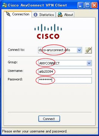anyconnect